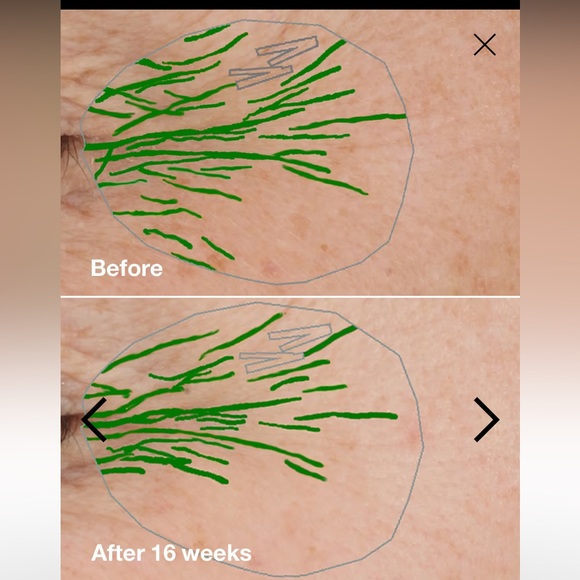 🌷SALE 2 FOR 75$🌺 CLINIQUE CLINICAL REPAIR WRINKLE CORRECTING SERU… - Picture 7 of 10